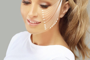 PDO Thread Lifts – Non Surgical Face Lift